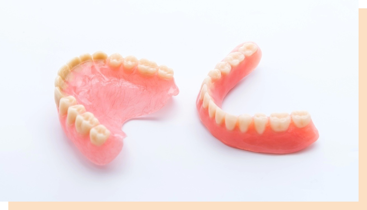 患者様一人ひとりに合わせた「個人トレー」をまずは作成します