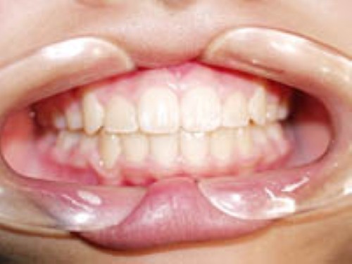 お子様から大人まで幅広い年代に対応した矯正歯科を行っています。