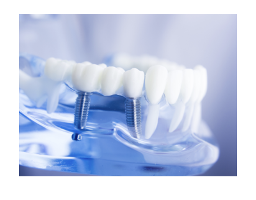 適切なケアを受けていただいた場合、5年間の保証を設けています