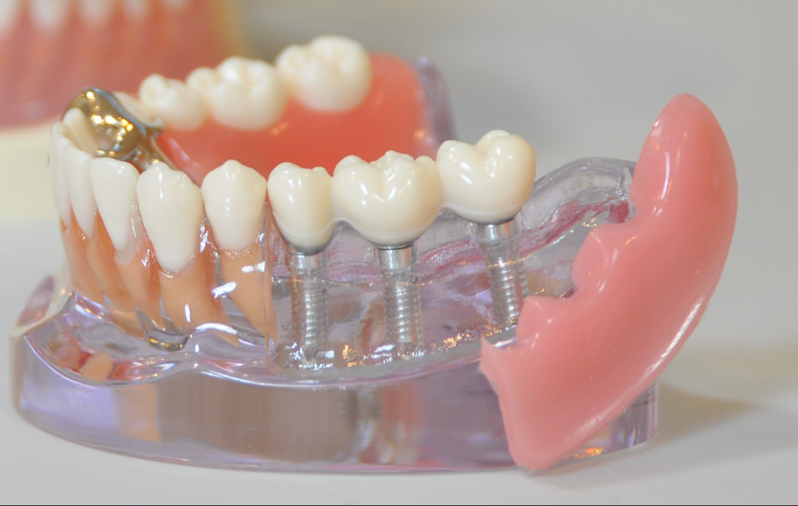 より安全にインプラント治療ができるように万全の環境を整えております