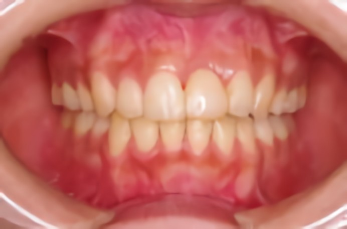 最適な治療法をご提案いたします