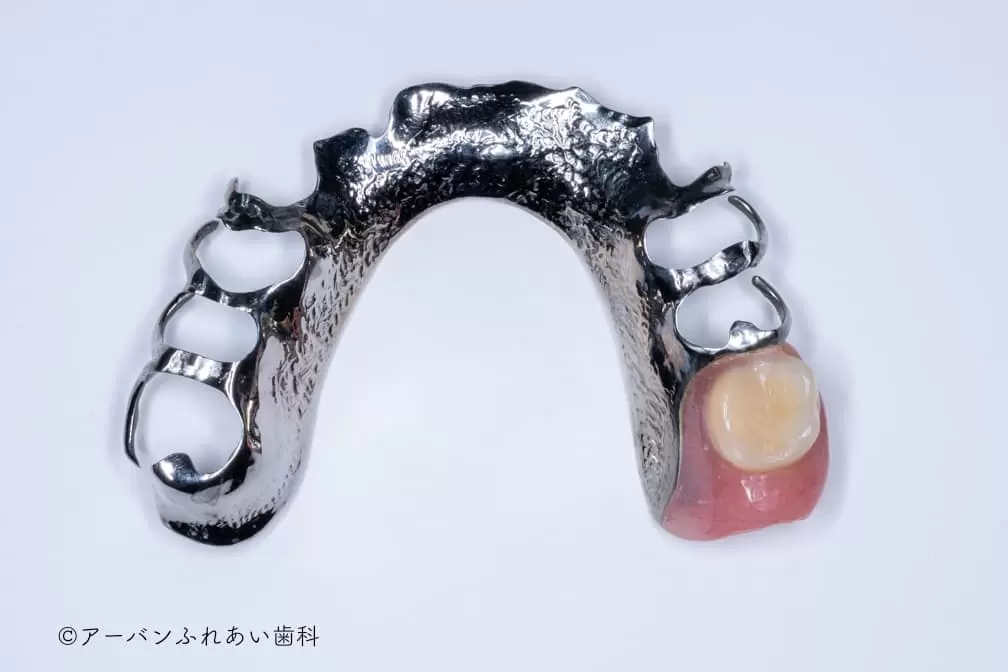 見た目や使用感に配慮した入れ歯・義歯の製作が行われています