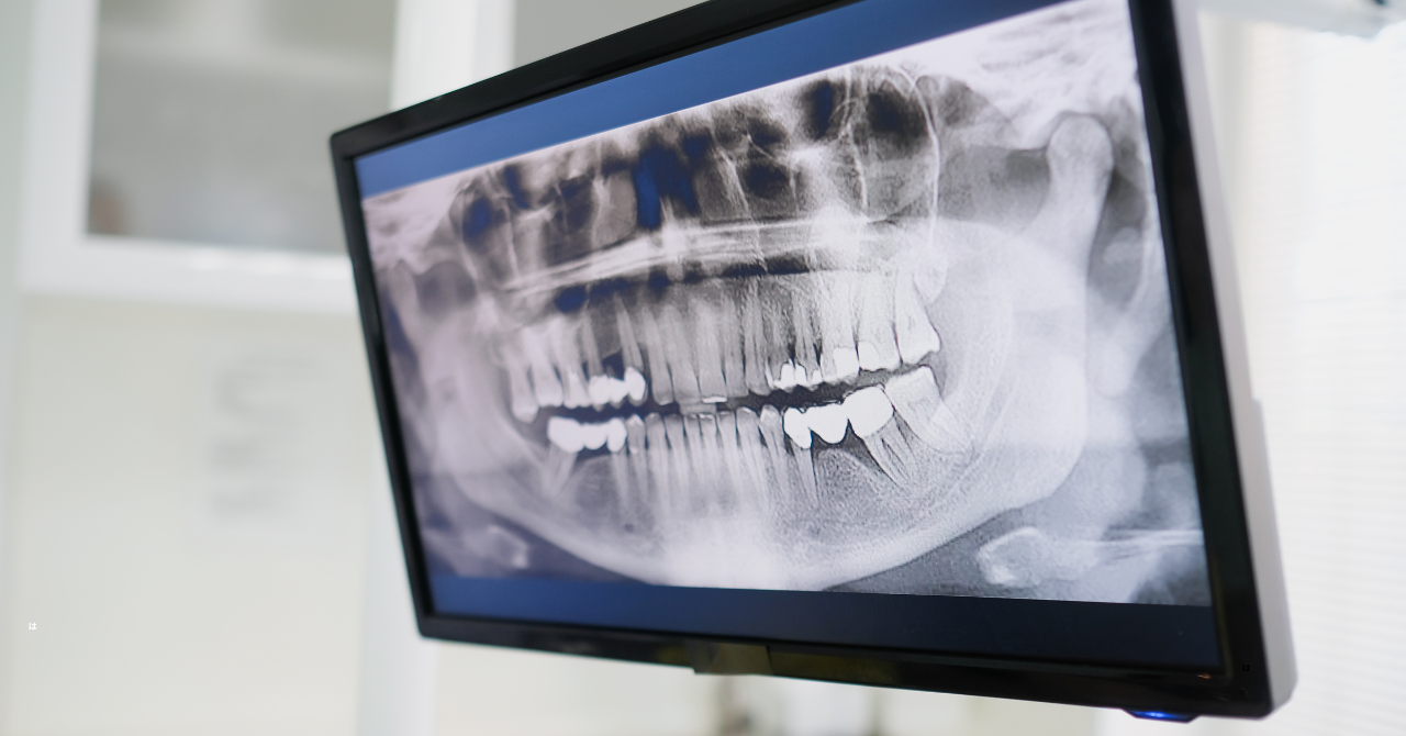 専門的な知識と経験を活かし、安心できる口腔外科治療を提供しています