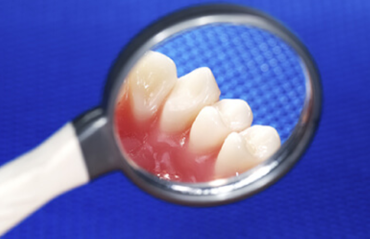 快適な装着感を追求した、一人ひとりに合わせた義歯を提供しています。