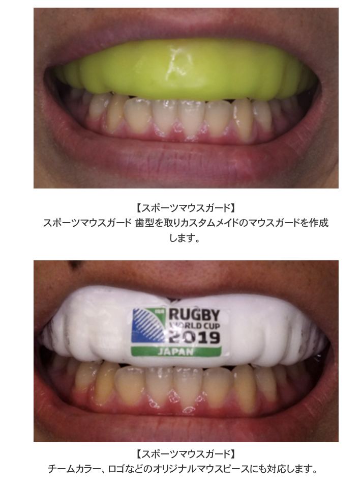 お一人おひとりに適したマウスガードの提供を心がけています