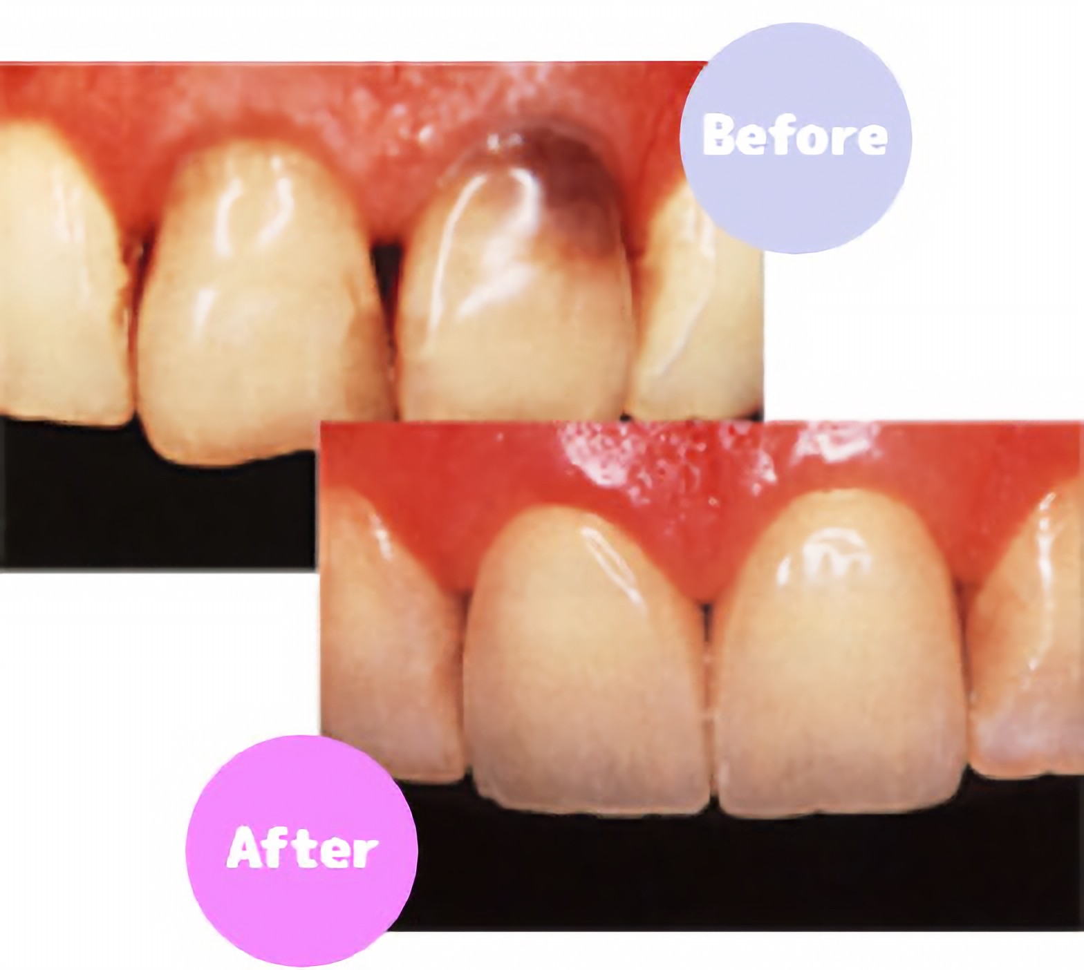 美しく健康的な口元に