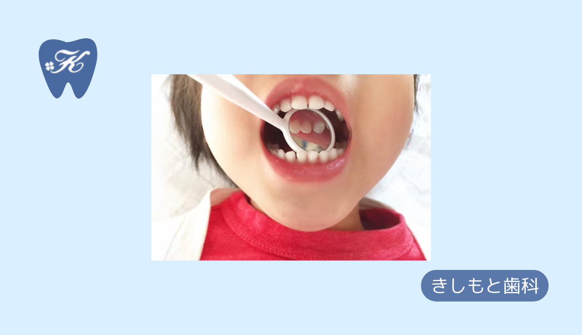【小児歯科】子どもの健康な歯を守るために