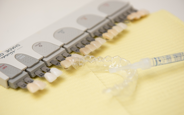 美しい白い歯を手に入れて、より自信に満ちた笑顔を実現しましょう