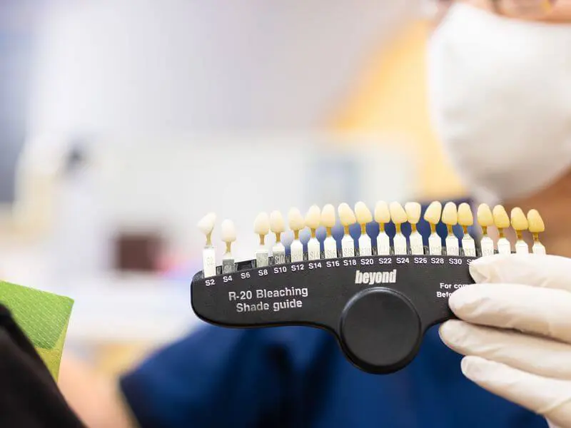 自然な白さと健康的な歯ぐきで、笑顔に自信を