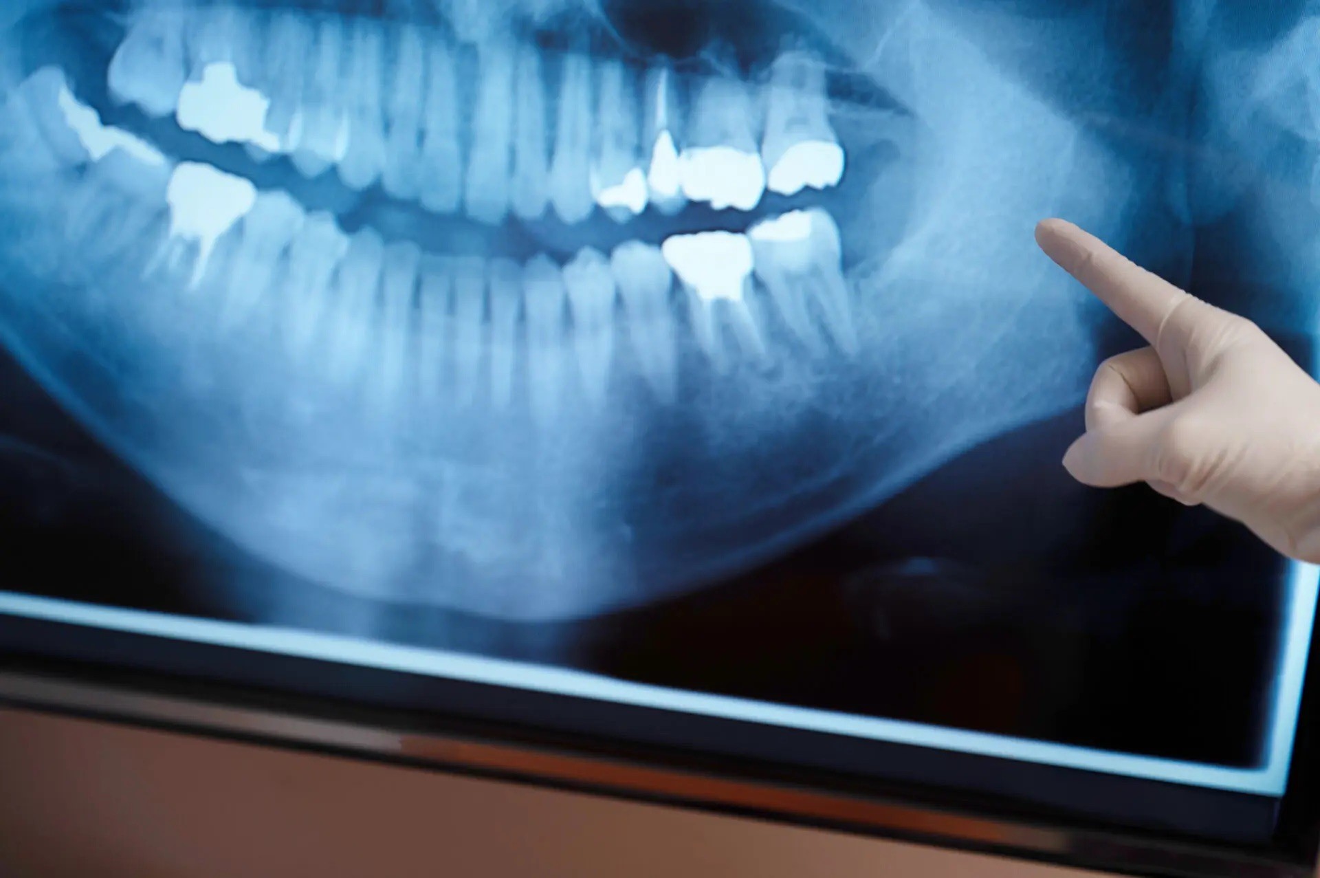 ①外観②丁寧な説明で安心できる診察③再発させない治療