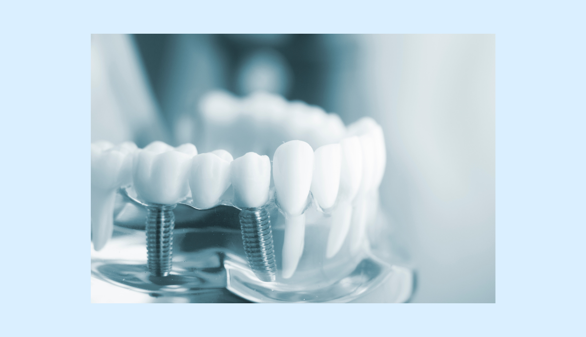 【郡津駅から車で6分】地域に根ざした安心の診療を届ける「おがた歯科」