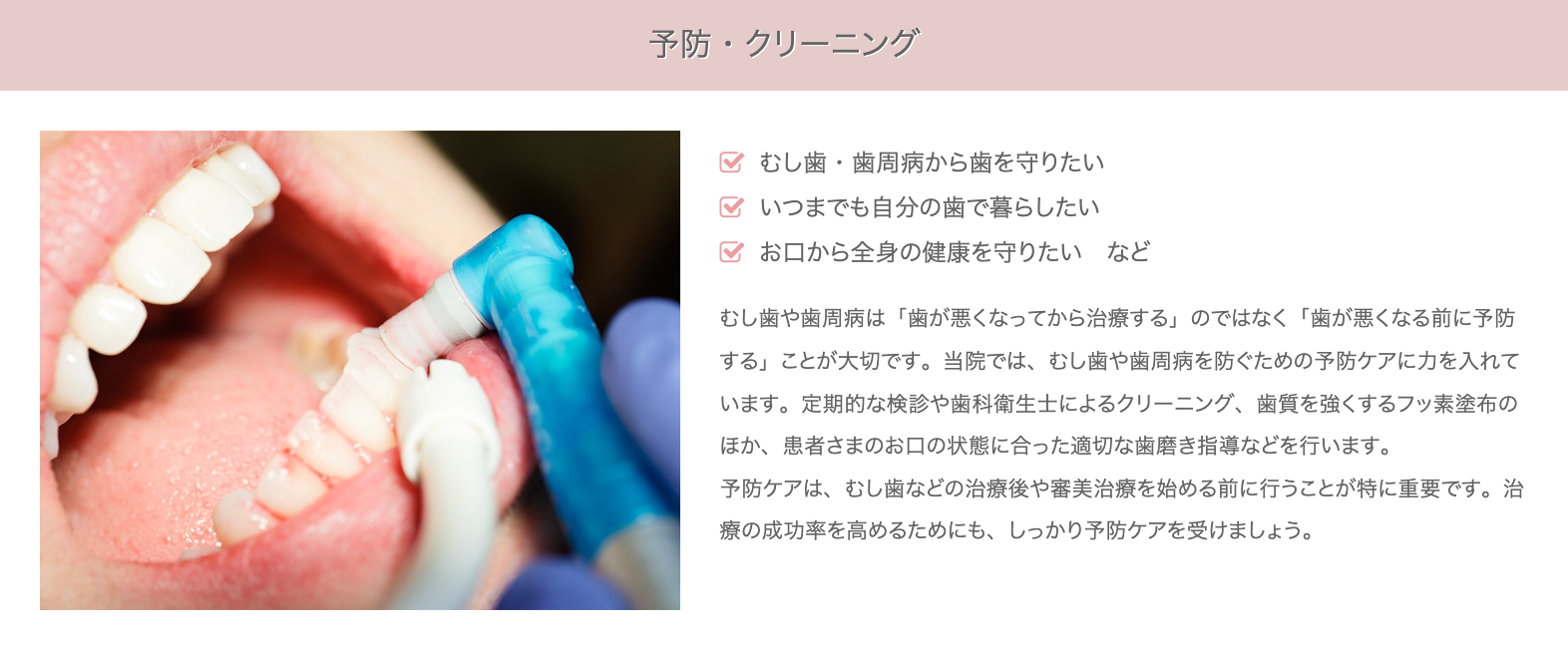 患者様のお口の状態に合わせた定期的なクリーニングを行い、歯垢や歯石、着色汚れを取り除きます