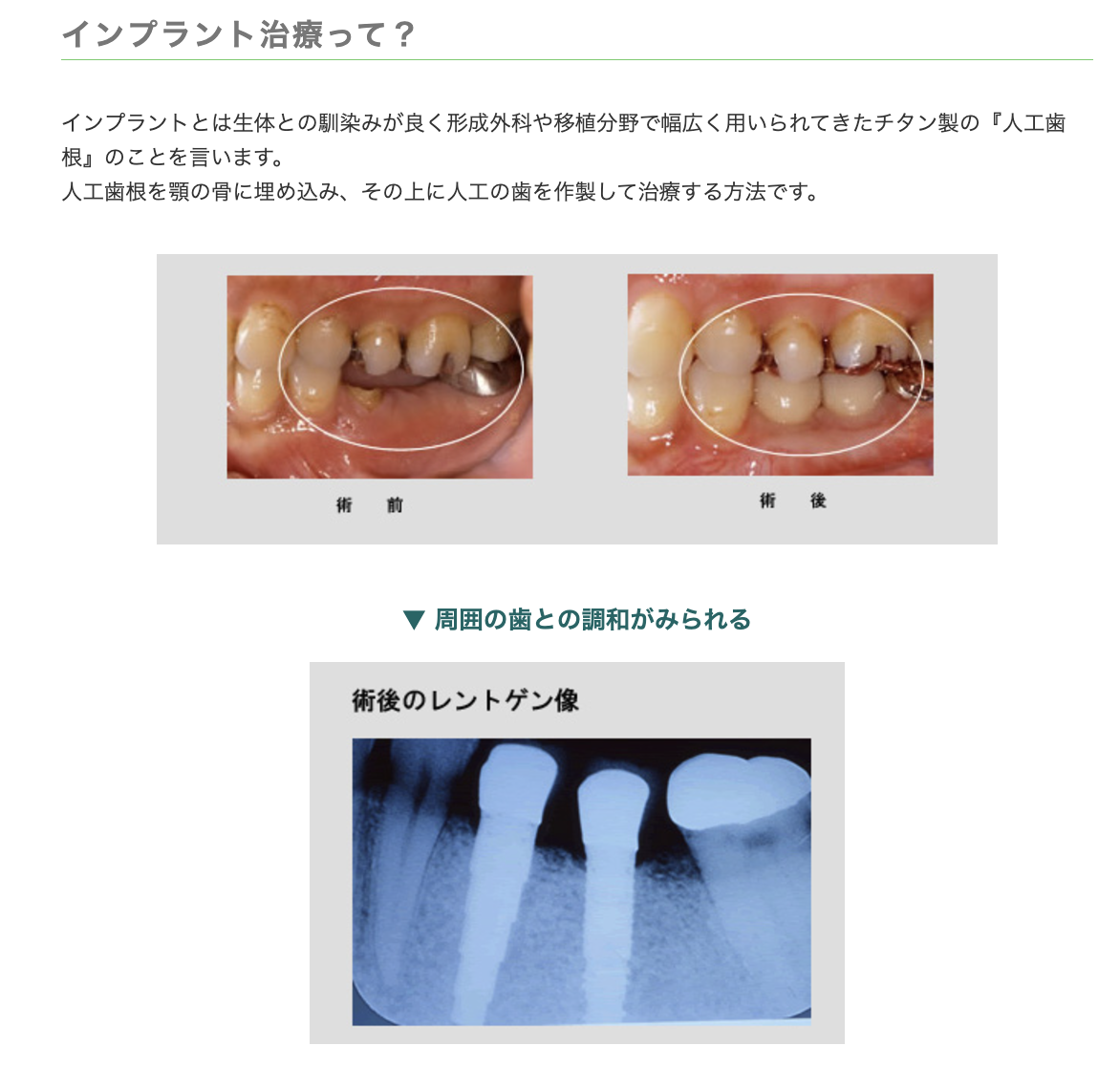 患者様と一緒に最適な治療方法を検討し、一人ひとりに合わせた治療計画を立てています