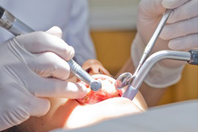 保険治療と自由治療