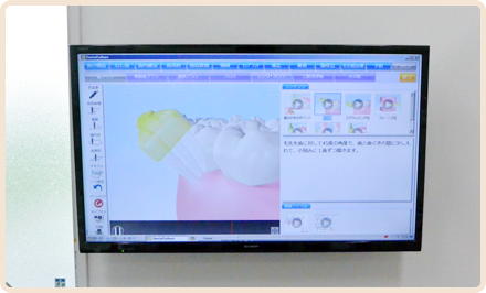 説明用のモニターにてわかりやすい説明を行っています