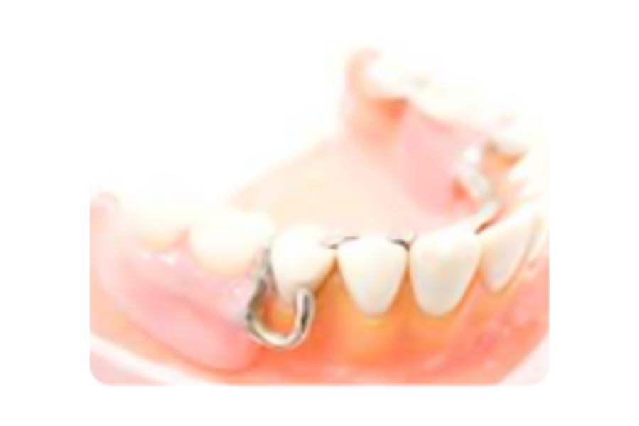 歯を失ってしまった場合にも様々な選択肢があります