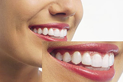 患者様のご希望に沿った仕上がりを目指します