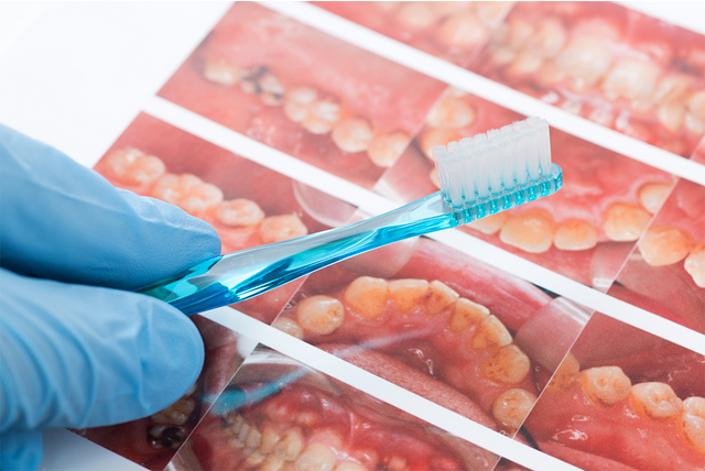 歯・歯周ポケットをキレイにするデンタルフローを完備