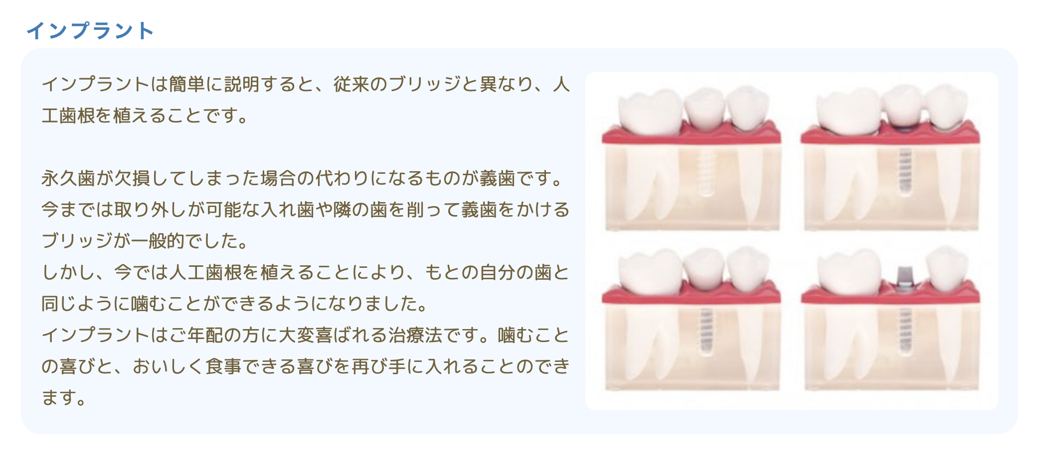 患者様が再び快適に食事を楽しめるようサポートしています