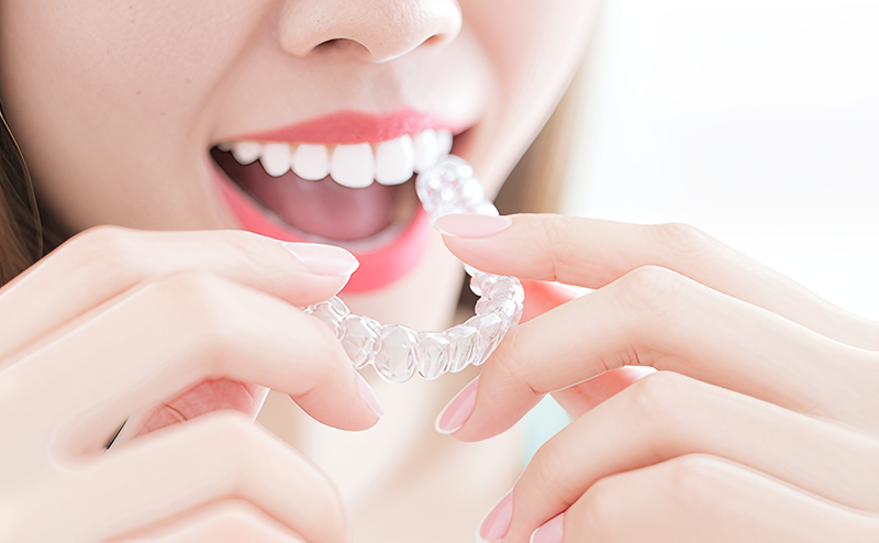 年齢や状態に合わせた最適な矯正装置で理想的な歯並びを実現