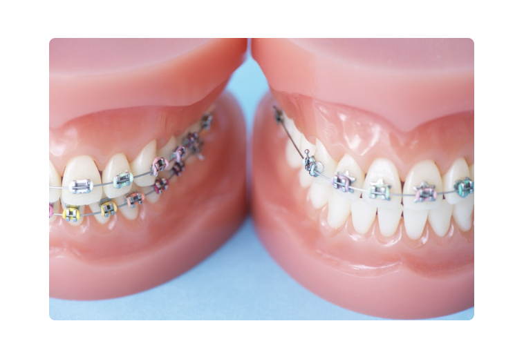快適で長期的な効果が得られる矯正治療を心がけています