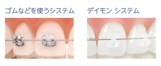 デイモンシステムを採用