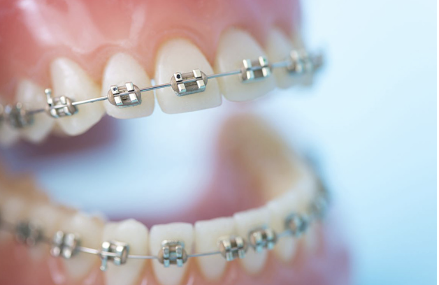 目立ちにくい装置や取り外し可能なタイプも取り扱っております