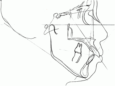 事前の治療計画は欠かせません