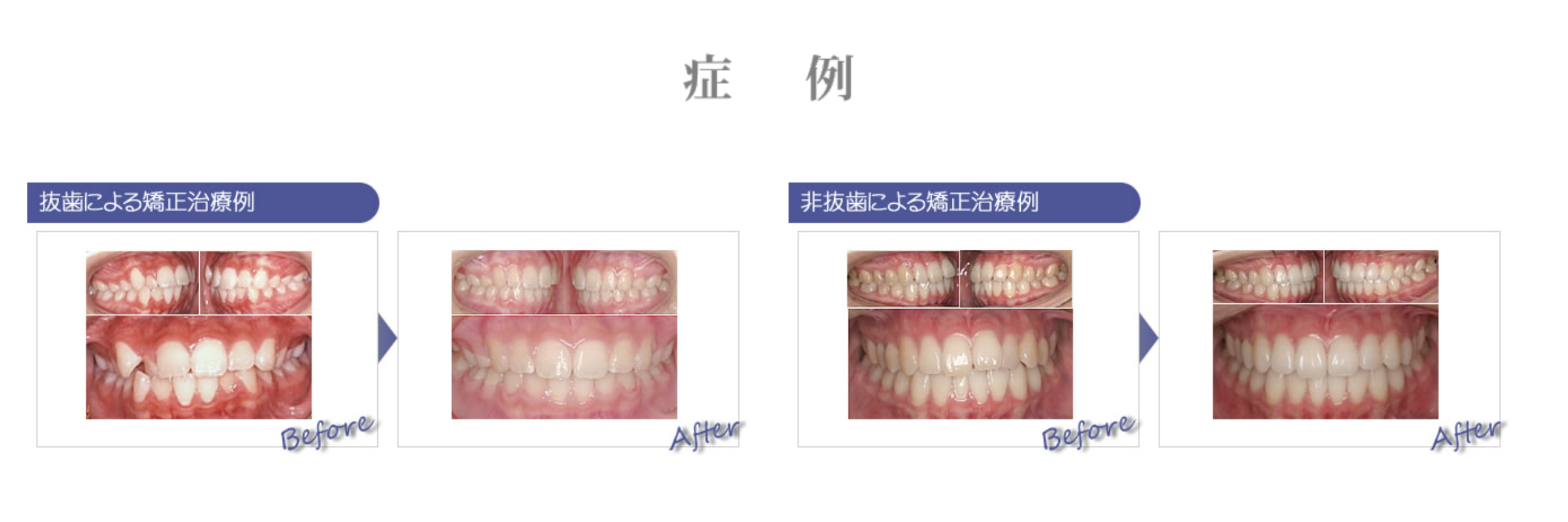 患者様一人ひとりの状態に応じた治療計画を立て、適切な治療を提供します