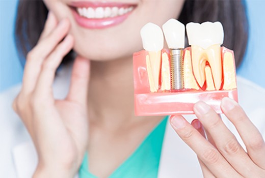 失った歯を取り戻し、健やかな生活を