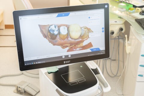 セレックという補綴物を短時間で製作するシステムを活用しています