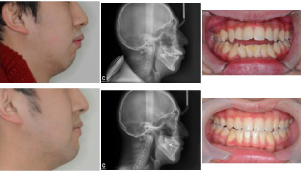 理想の歯並びを目指して、症状と向き合います