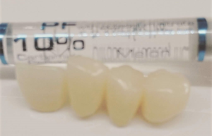 審美的な治療が可能です