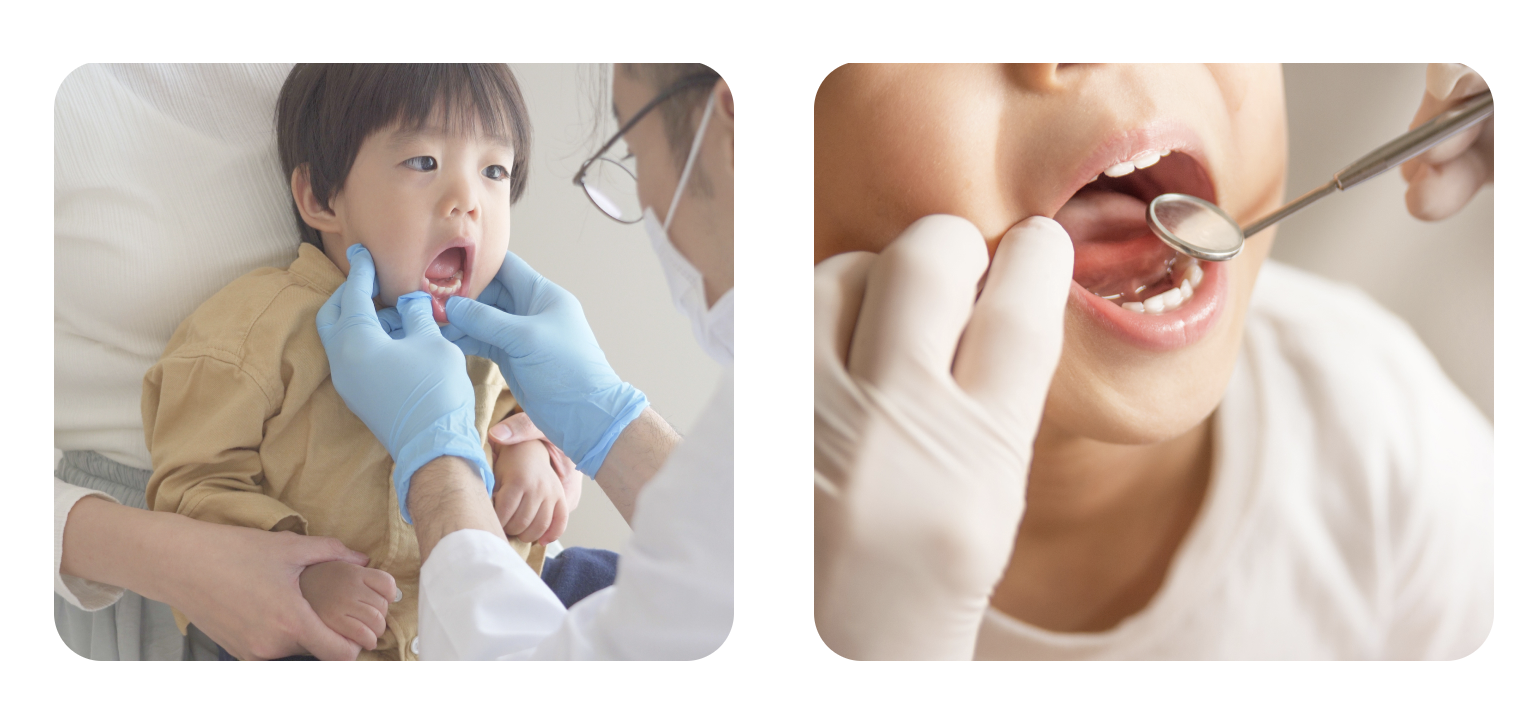 歯並びが気になる場合、まずは状態を確認し、必要な処置について検討することが大切です