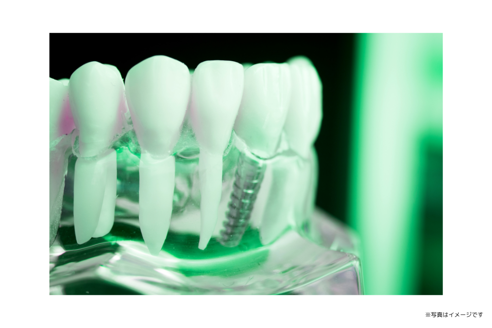 歯を失った後の噛む機能を回復しています