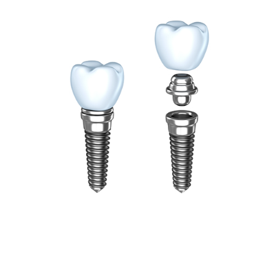 失った歯の機能を回復する治療法として、自然な見た目と噛み心地を提供します