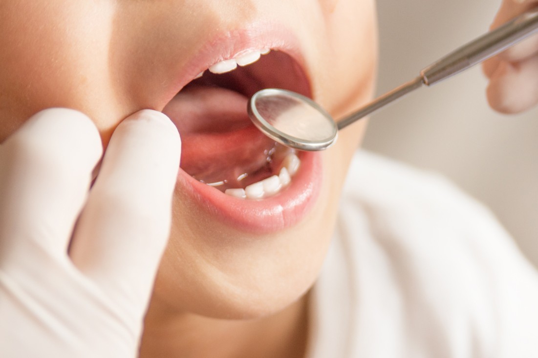 「痛みがなくても通う」ことを大切にした予防歯科に力を入れています