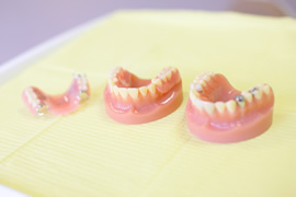 ぴったりの入れ歯を作ります