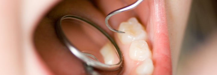 精度の高い治療を実現しています