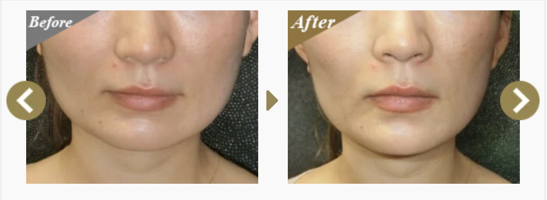 それぞれの原因に合わせたブラキシズム治療（歯ぎしり治療）