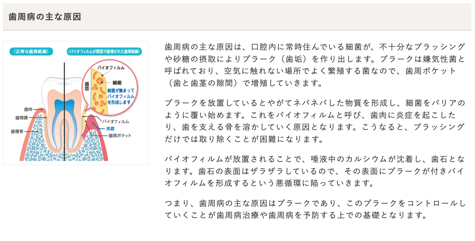 日々のセルフケアを通して歯周病リスクを低減できるようサポートしています