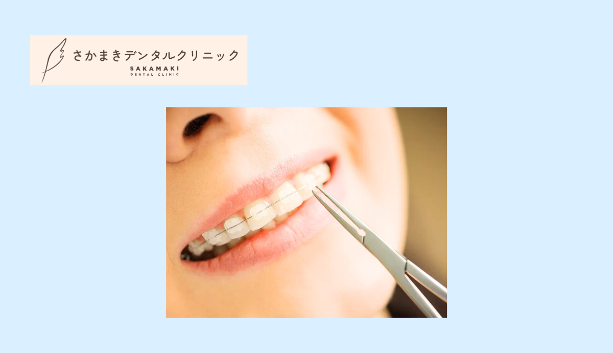 矯正歯科できれいな歯並びで心も前向きに