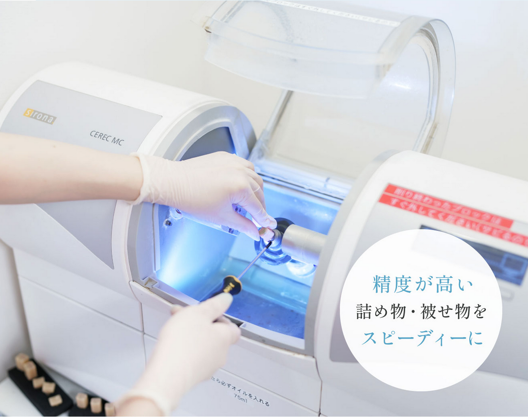 被せ物・詰め物をより精密に、早く製作することが可能なCEREC（セレック）