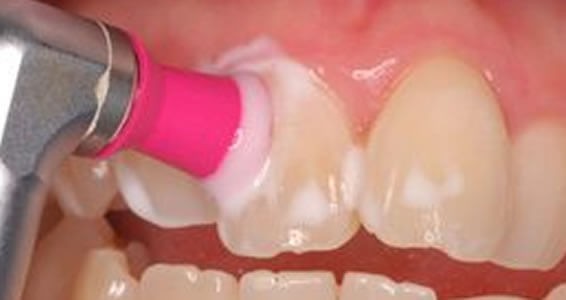 定期的なメンテナンスを受けましょう