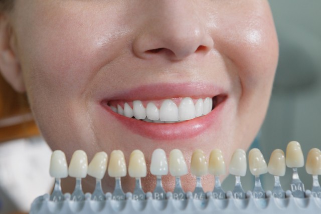 自然な美しさと機能性の両立を図り、長く満足できる審美治療を提供しています。※写真はイメージです。