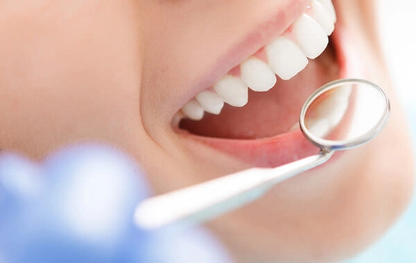 ご自宅のペースで進められるホームホワイトニングです