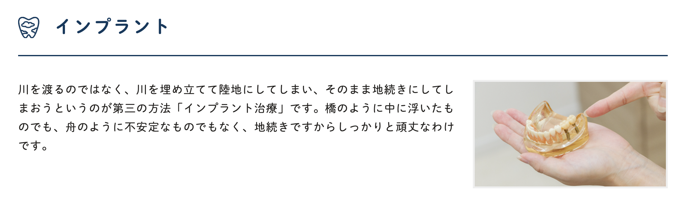 患者様の生活の質を向上させるため、最新のインプラントシステムを導入しています
