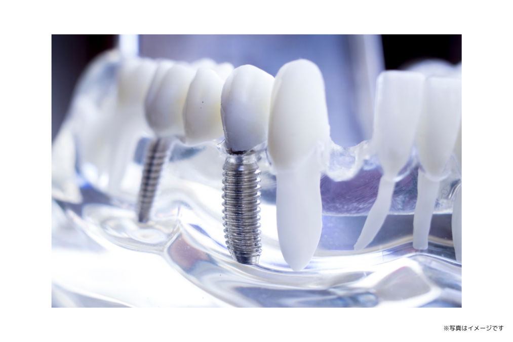 3Dレントゲンを活用し精密な検査を行っています