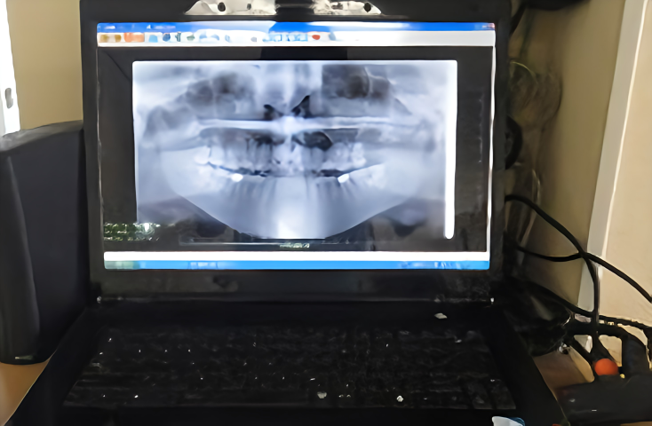 健康な歯を維持する高塚歯科医院の予防プログラム