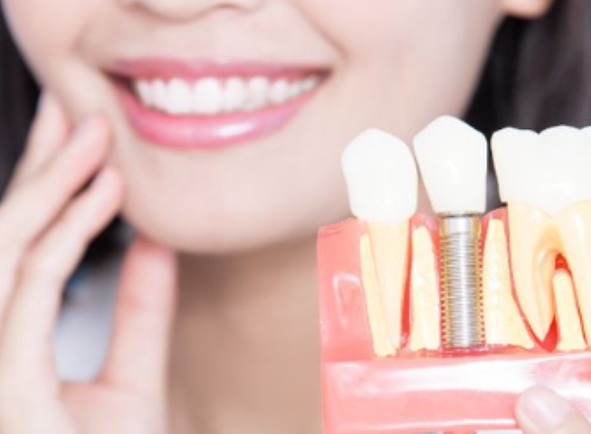 歯を失わないために